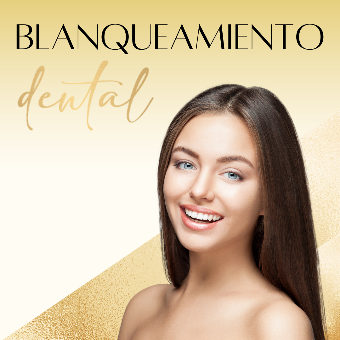 Blanqueamiento Dental