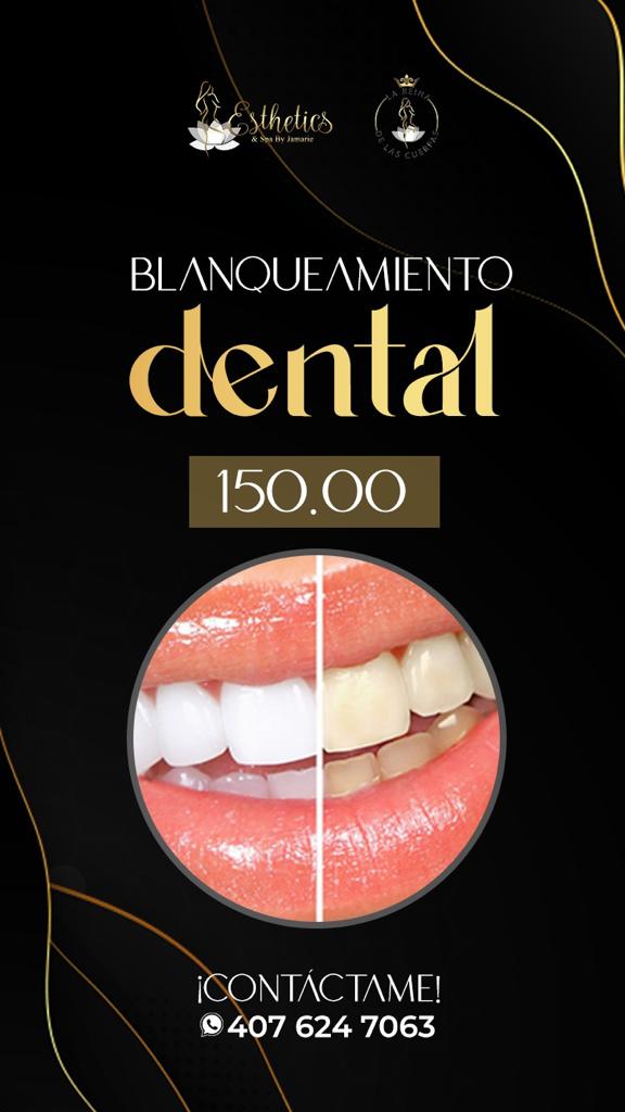 Blanqueamiento Dental